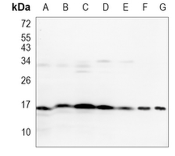 p16 ARC Rabbit Monoclonal Antibody