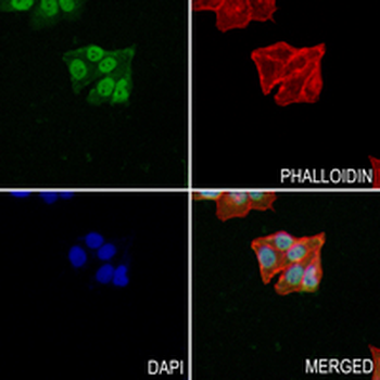 DMAP1 Rabbit Monoclonal Antibody
