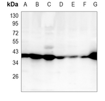 MHC class I Rabbit Monoclonal Antibody