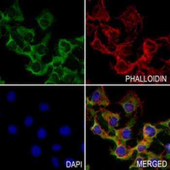 WNT2B Rabbit Monoclonal Antibody