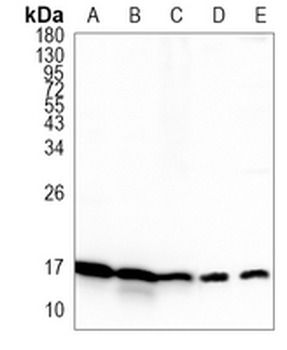 UBCH5 Rabbit Monoclonal Antibody