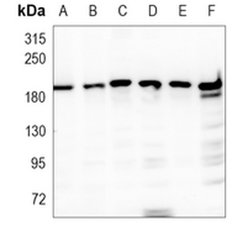 Clathrin Heavy Chain Rabbit Monoclonal Antibody