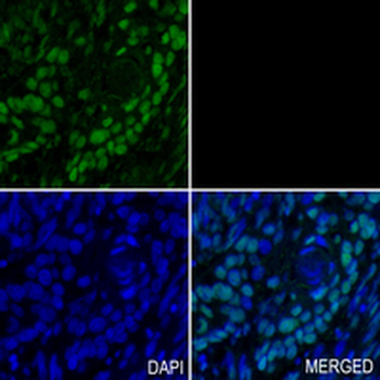 SNRPA1 Rabbit Monoclonal Antibody