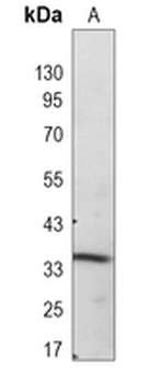 SRR Rabbit Monoclonal Antibody