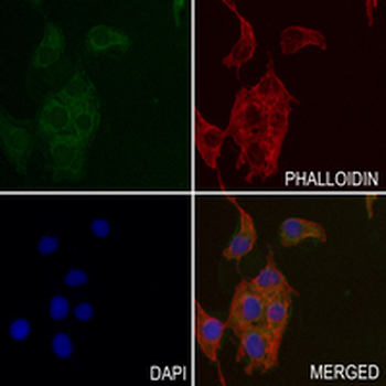 Cadherin-pan Rabbit Monoclonal Antibody