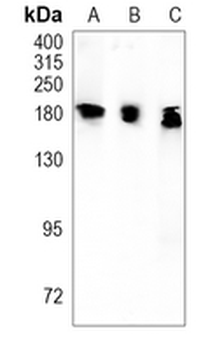 ATP2B1 Rabbit Monoclonal Antibody