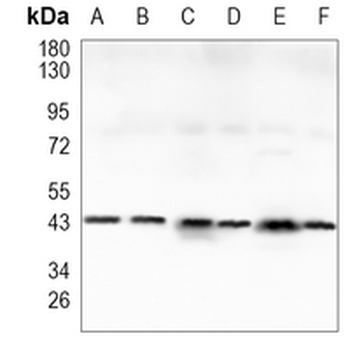 GAP43 Rabbit Monoclonal Antibody