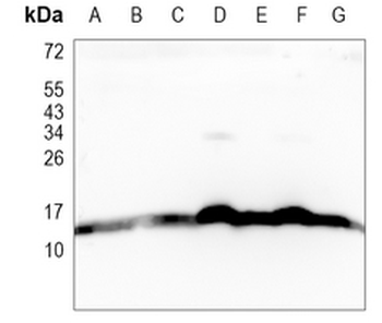 NDUFB4 Rabbit Monoclonal Antibody