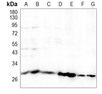 SDHB Rabbit Monoclonal Antibody