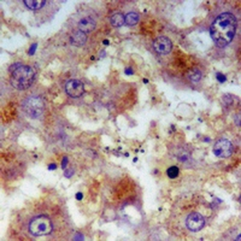 SDHB Rabbit Monoclonal Antibody