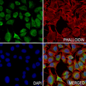 SDHB Rabbit Monoclonal Antibody