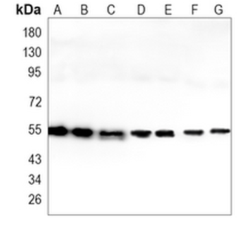 TFG Rabbit Monoclonal Antibody