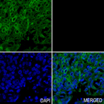 TFG Rabbit Monoclonal Antibody