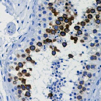 CD168 Rabbit Monoclonal Antibody