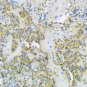 RKIP Rabbit Monoclonal Antibody