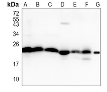 DHFR Rabbit Monoclonal Antibody