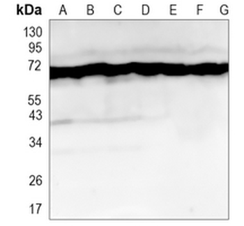 HSP70 Rabbit Monoclonal Antibody