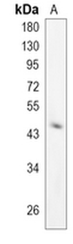 PREB Rabbit Monoclonal Antibody