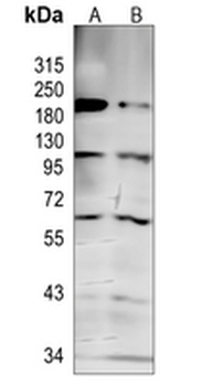 EZH2 Rabbit Monoclonal Antibody