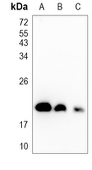 ARF1 Rabbit Monoclonal Antibody