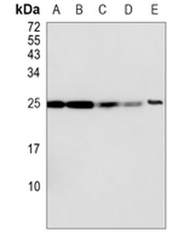RPL10A Rabbit Monoclonal Antibody