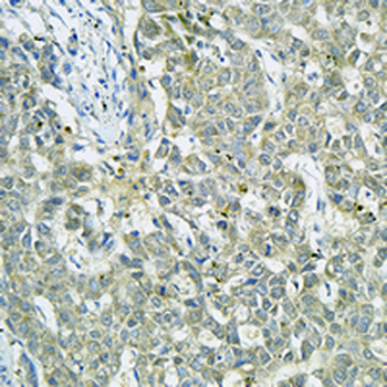 AK4 Rabbit Monoclonal Antibody