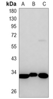 Fibrillarin Rabbit Monoclonal Antibody