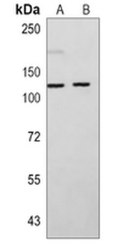 OGT Rabbit Monoclonal Antibody