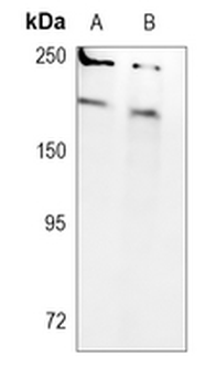 SMCHD1 Rabbit Monoclonal Antibody