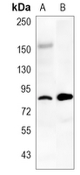 CD36 Rabbit Monoclonal Antibody