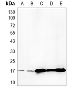 Histone H3 (Lactyl-K18) Rabbit Monoclonal Antibody