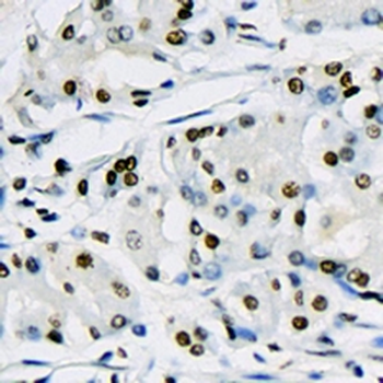 Histone H3 (Lactyl-K18) Rabbit Monoclonal Antibody