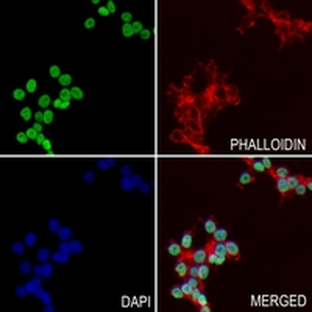 Histone H3 (Lactyl-K18) Rabbit Monoclonal Antibody