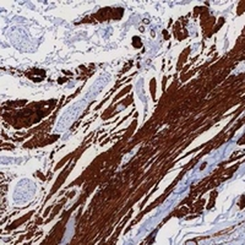 Calponin 1 Rabbit Monoclonal Antibody