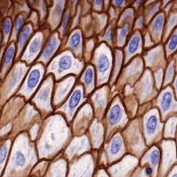TACSTD2 Rabbit Monoclonal Antibody