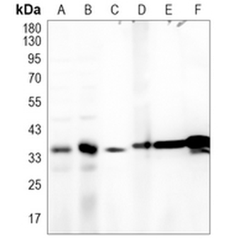 STING Rabbit Monoclonal Antibody