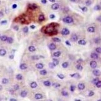 PDK1 Rabbit Monoclonal Antibody