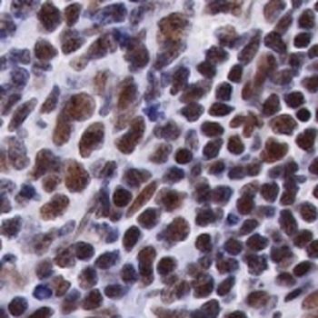 Ku80 Rabbit Monoclonal Antibody