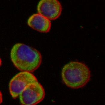 HLA-DPB1 Rabbit Monoclonal Antibody