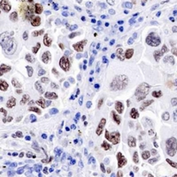 EZH2 Rabbit Monoclonal Antibody