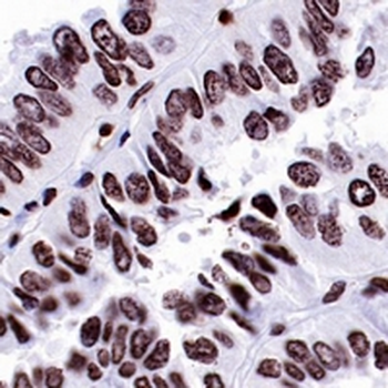 ERCC1 Rabbit Monoclonal Antibody