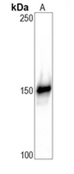 CD43 Rabbit Monoclonal Antibody