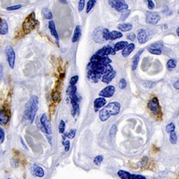 CD169 Rabbit Monoclonal Antibody