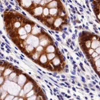 Caspase 7 Rabbit Monoclonal Antibody