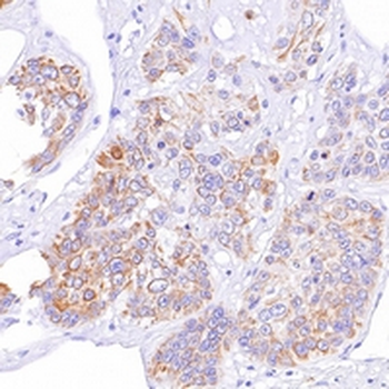 CD103 Rabbit Monoclonal Antibody