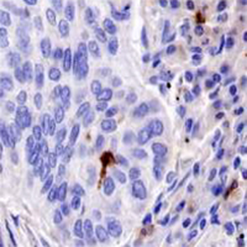 CD103 Rabbit Monoclonal Antibody