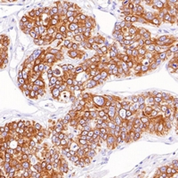 Gi24 Rabbit Monoclonal Antibody