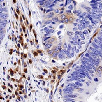 Gi24 Rabbit Monoclonal Antibody