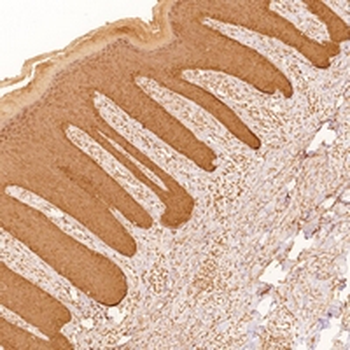 Keratin 6 Rabbit Monoclonal Antibody