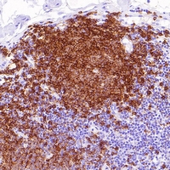CD20 Rabbit Monoclonal Antibody